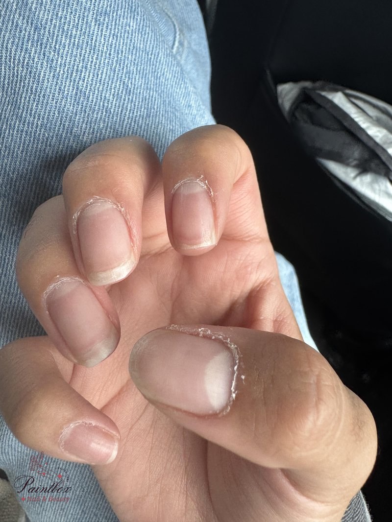 cuticle peeling : r/lacqueristas