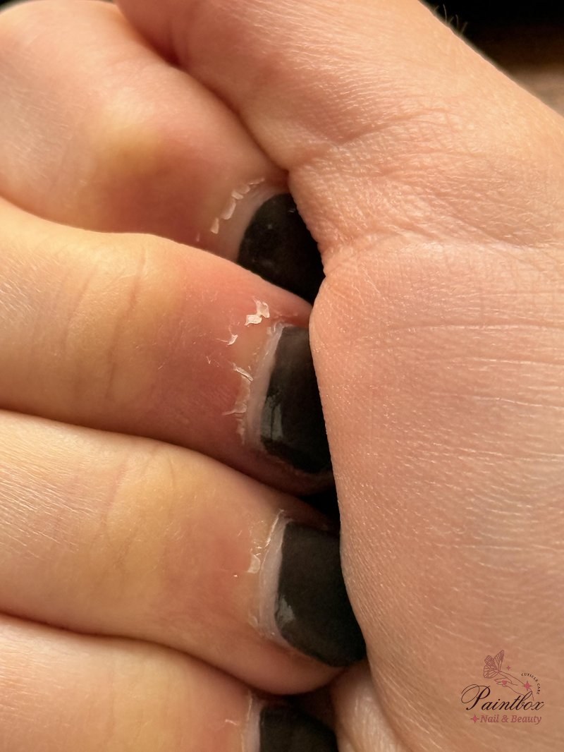 Cuticles get super dry after manicures – what am I doing wrong?