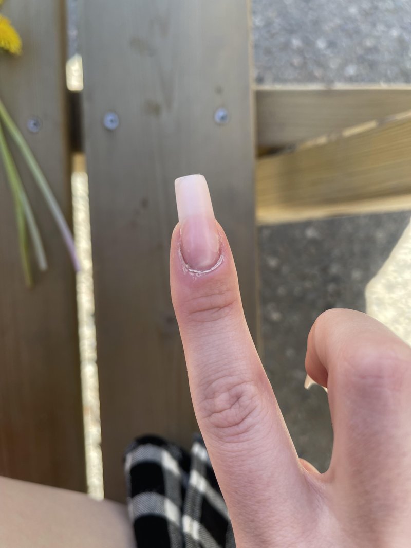 Addressing dry and hard cuticles