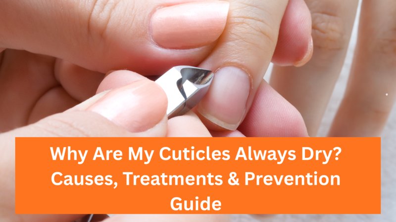 Why Are My Cuticles Always Dry? Causes & Care
