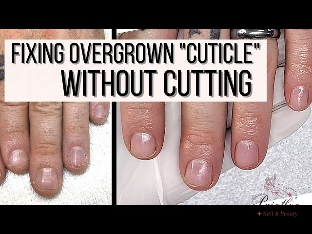 Learning how to fix overgrown cuticles without cutting them